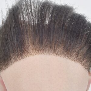 Mens-Lace-Frontal-Hair-Piece-6